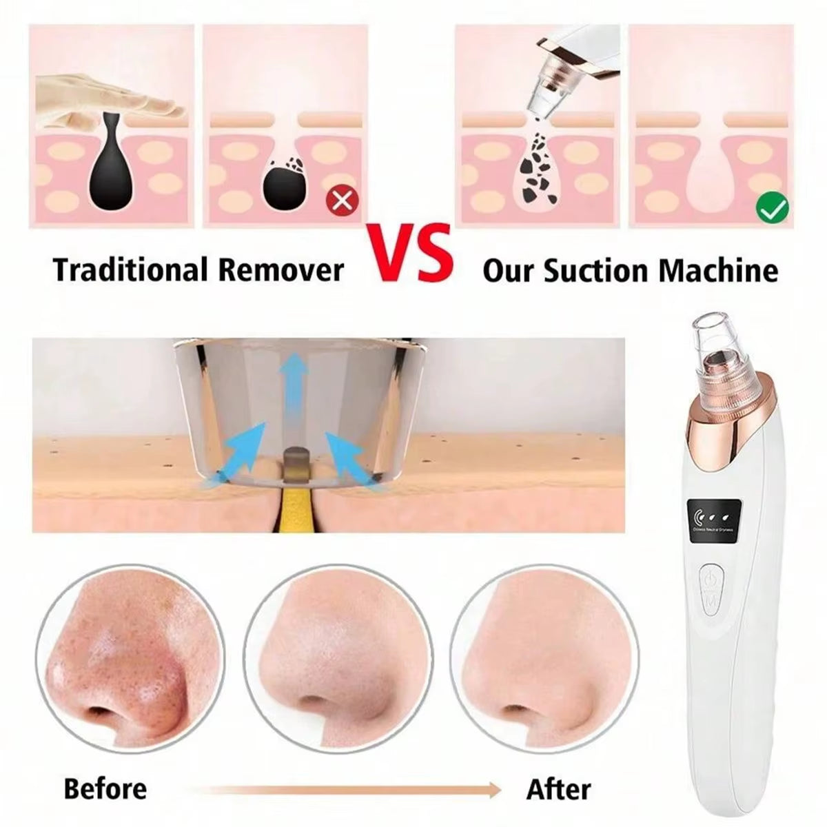 Electric Pore Cleaner & Blackhead Remover